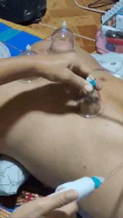 GIF 1