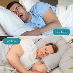 Σετ Μαγνητικού Ρινικού Διαστολέα για Βελτίωση της Αναπνοής 70 τεμάχια